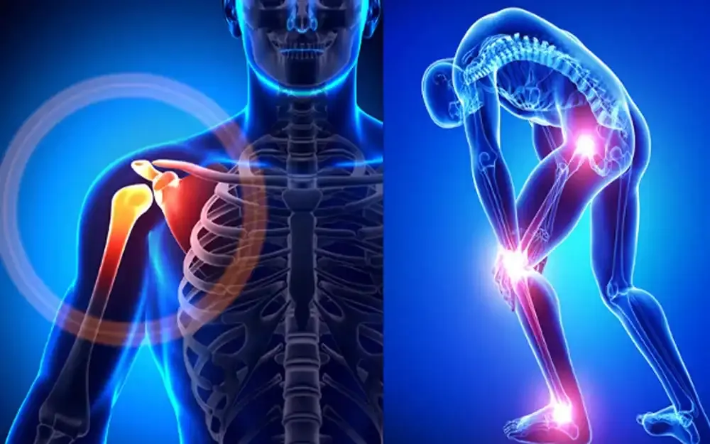 Orthopaedic Physiotherapy