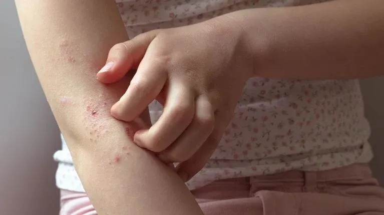 Skin conditions and allergies