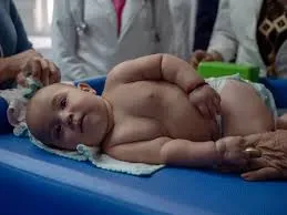 Prematurity follow-up