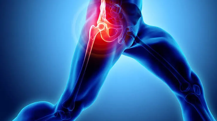 Hip Pain and Arthritis
